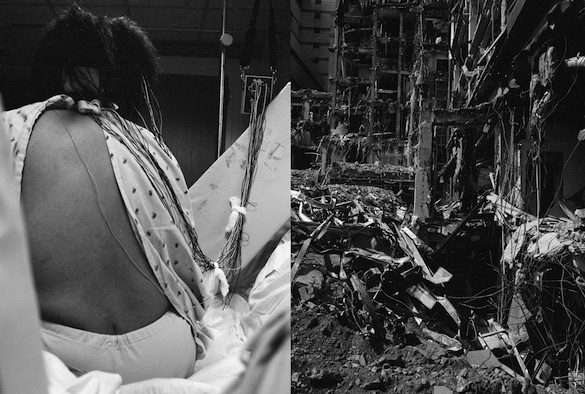 LaToya Ruby Frazier, Landscape of the Body (Epilepsy Test), 2011. Tirage gélatino-argentique monté sur carton, 60,1 × 101,6 cm. Courtesy Galerie Michel Rein, Paris. © LaToya Ruby Frazier